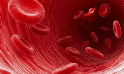 globulos rojos viajando por el torrente sanguíneo de una arteria